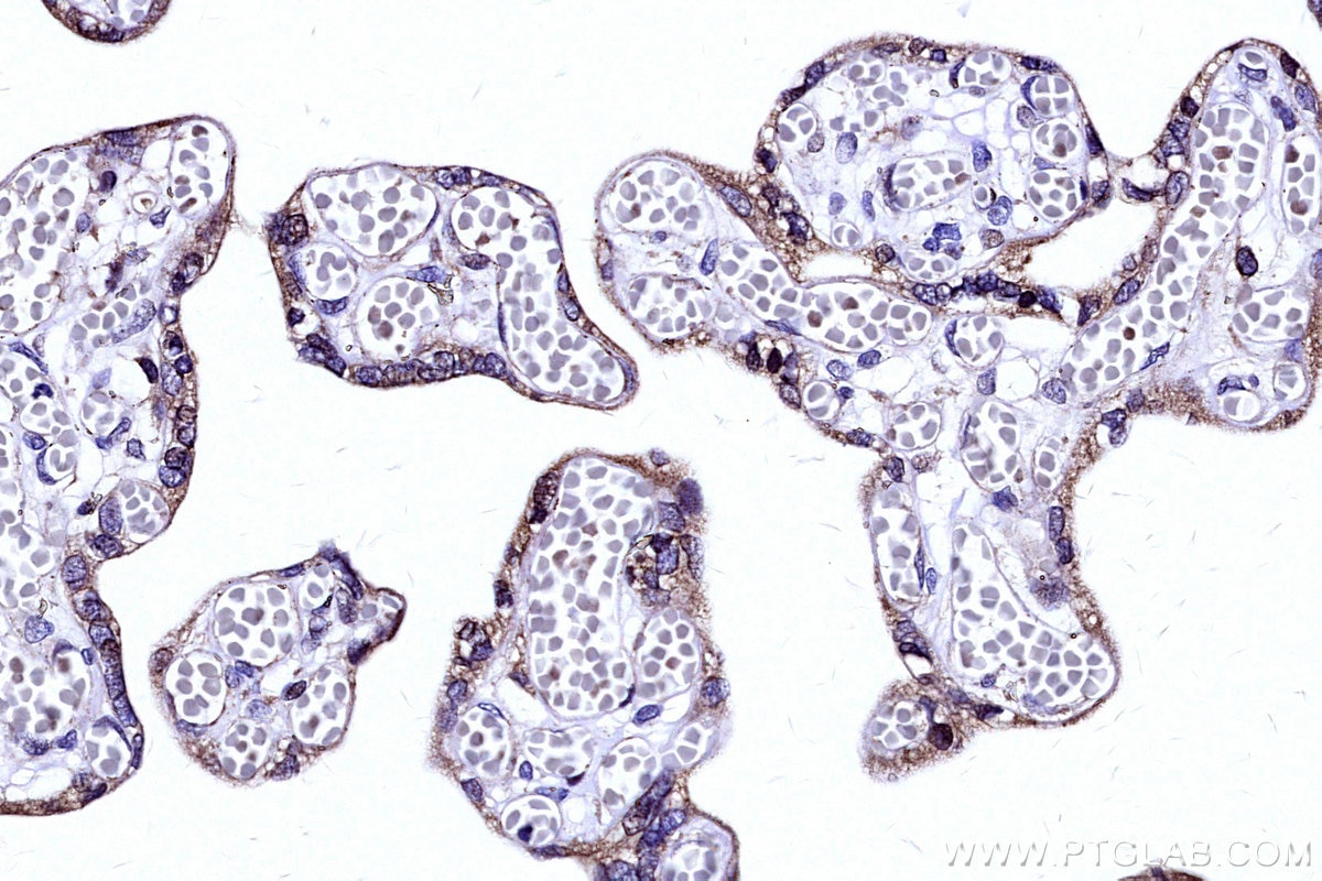 IHC staining of human placenta using 19889-1-AP Immunohistochemistry (IHC) staining of human placenta tissue using COX4NB Polyclonal antibody (19889-1-AP)