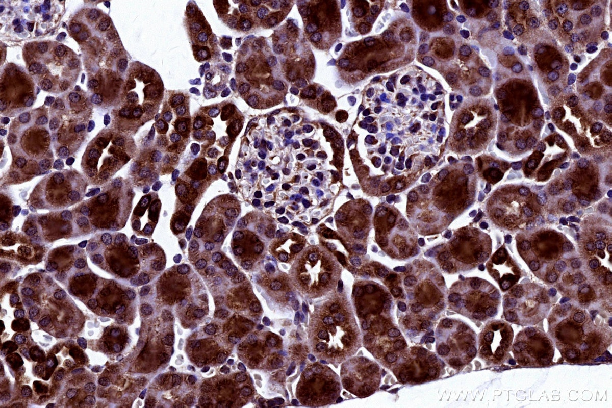 IHC staining of mouse kidney using 19889-1-AP Immunohistochemistry (IHC) staining of mouse kidney tissue using COX4NB Polyclonal antibody (19889-1-AP)