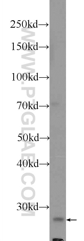 Western Blot (WB) analysis of COLO 320 cells using COX4NB Polyclonal antibody (19889-1-AP)