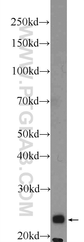 Western Blot (WB) analysis of mouse pancreas tissue using COX4NB Polyclonal antibody (19889-1-AP)