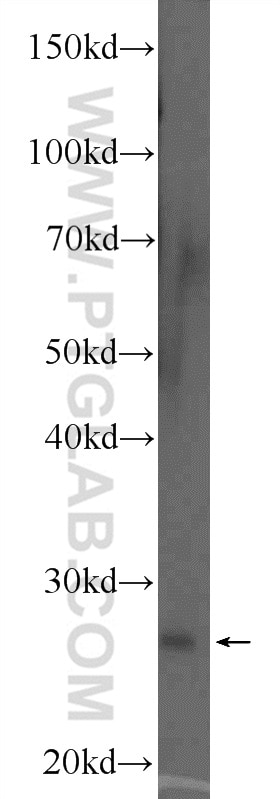 Western Blot (WB) analysis of human placenta tissue using COX4NB Polyclonal antibody (19889-1-AP)