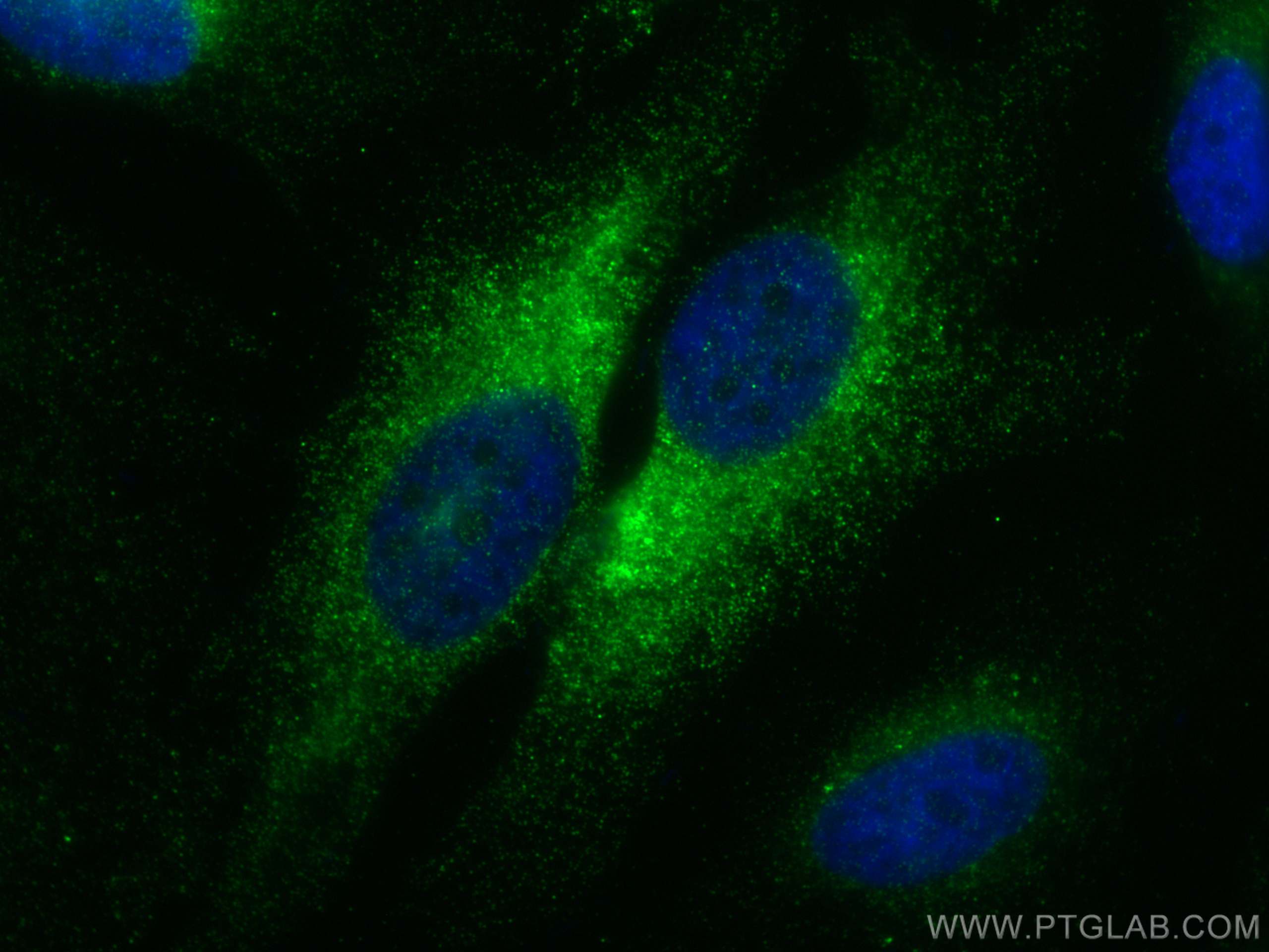 Immunofluorescence (IF) / fluorescent staining of HeLa cells using COX4NB Monoclonal antibody (66547-1-Ig)