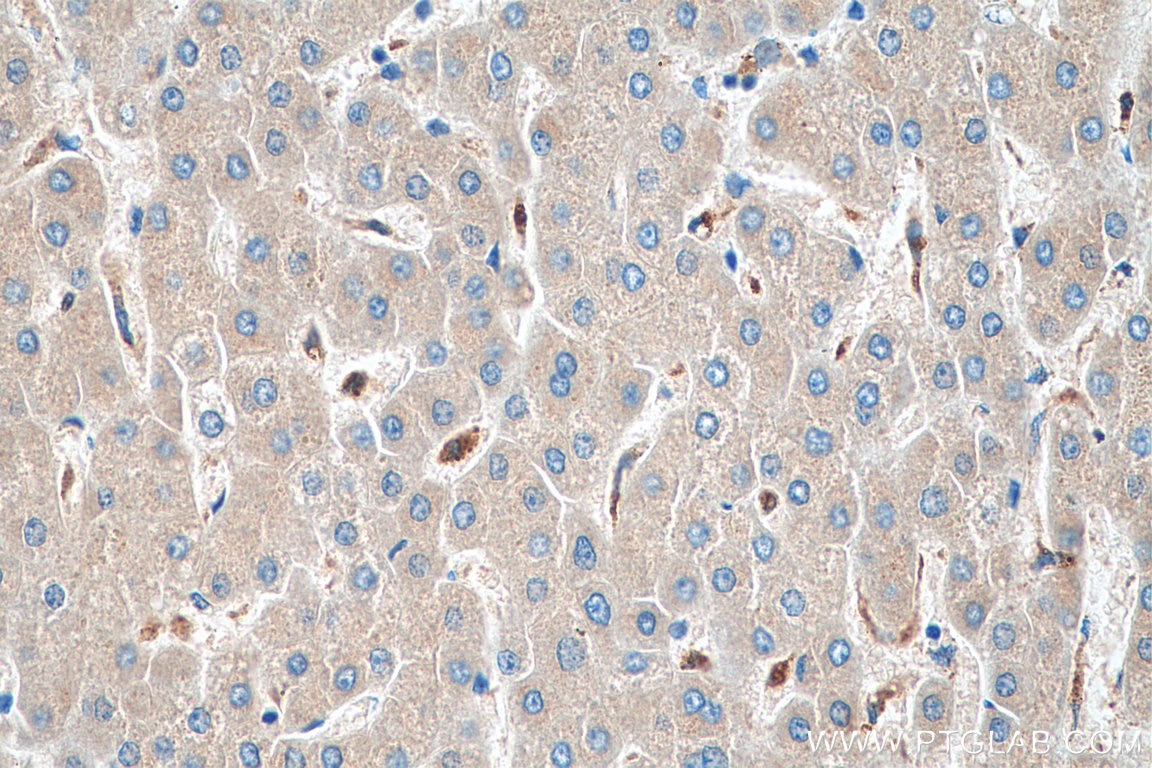 Immunohistochemistry (IHC) staining of human liver tissue using COX4NB Monoclonal antibody (66547-1-Ig)