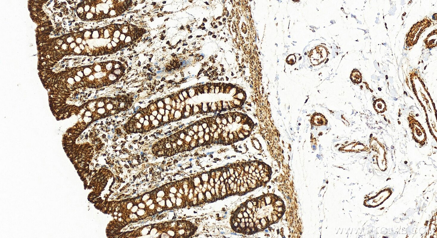 Immunohistochemistry (IHC) staining of human colon tissue using COX5A Polyclonal antibody (11448-1-AP)