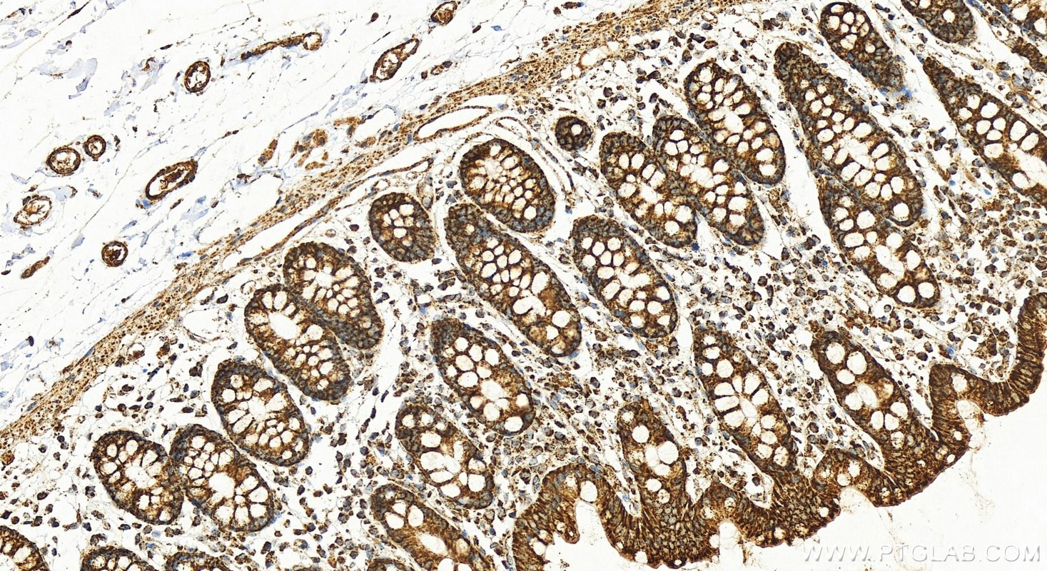 Immunohistochemistry (IHC) staining of human colon tissue using COX5A Polyclonal antibody (11448-1-AP)