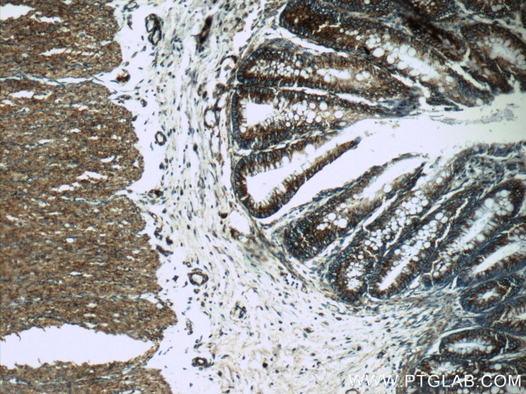 Immunohistochemistry (IHC) staining of human colon tissue using COX5A Polyclonal antibody (11448-1-AP)
