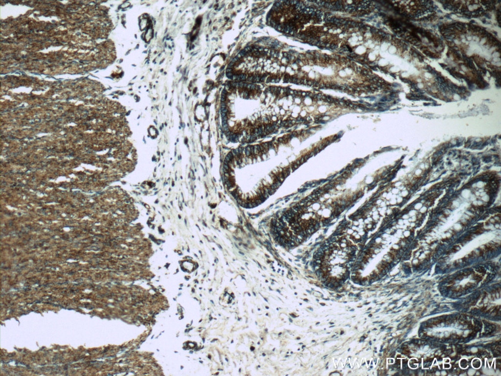 IHC staining of human colon using 11448-1-AP