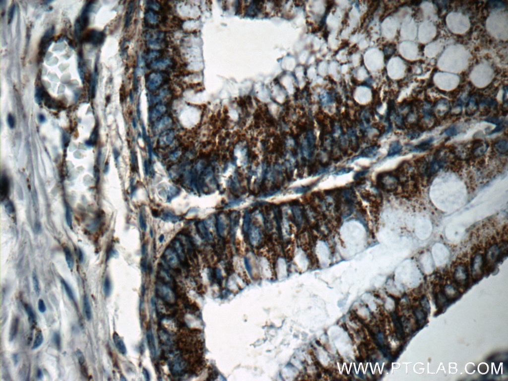 Immunohistochemistry (IHC) staining of human colon tissue using COX5A Polyclonal antibody (11448-1-AP)