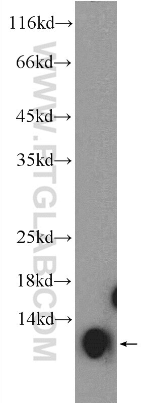 Western Blot (WB) analysis of rat brain tissue using COX5A Polyclonal antibody (11448-1-AP)