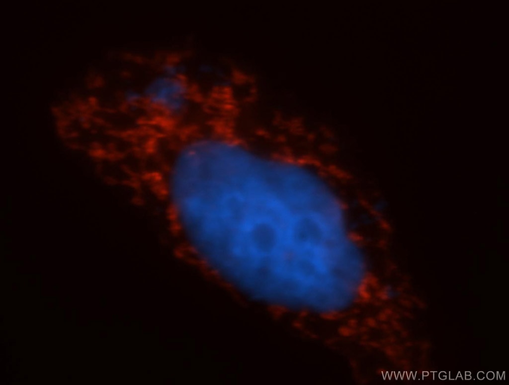 COX5B Polyclonal antibody