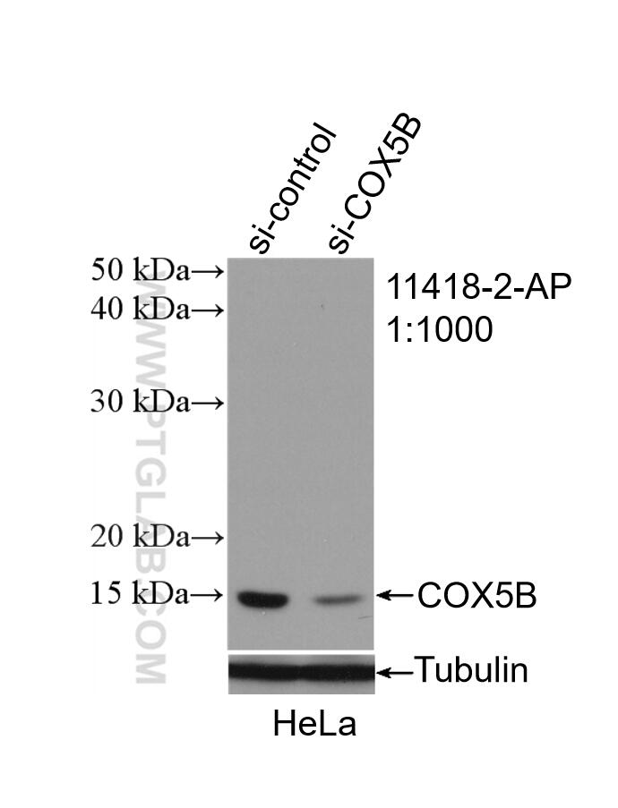 Western Blot (WB) analysis of HeLa cells using COX5B Polyclonal antibody (11418-2-AP)