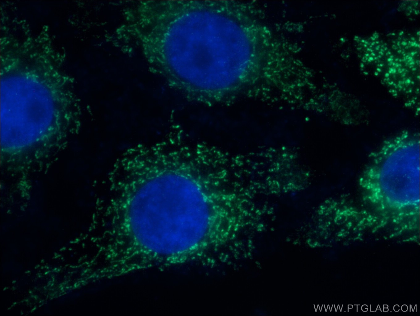 Immunofluorescence (IF) / fluorescent staining of SH-SY5Y cells using COX6A1 Polyclonal antibody (11460-1-AP)