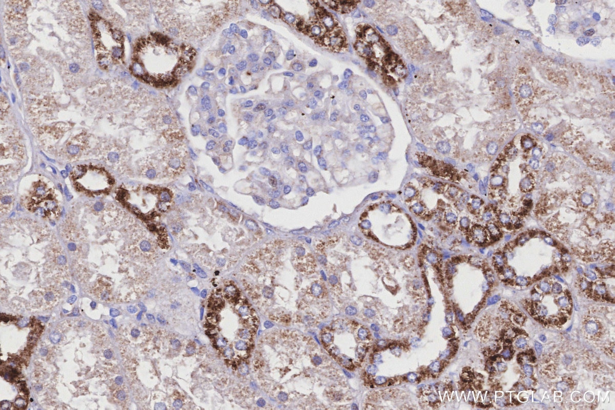 Immunohistochemistry (IHC) staining of human kidney tissue using COX6A1 Polyclonal antibody (11460-1-AP)