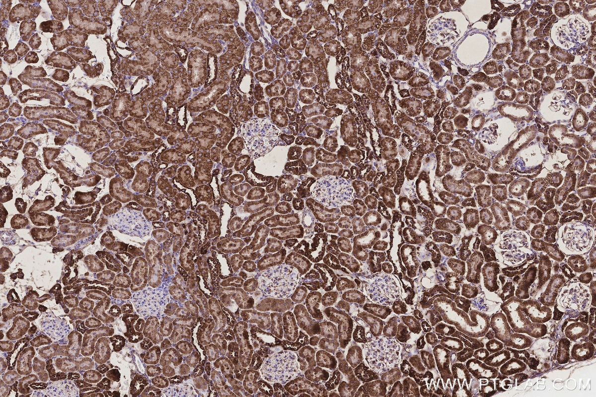 Immunohistochemistry (IHC) staining of rat kidney tissue using COX6A1 Polyclonal antibody (11460-1-AP)