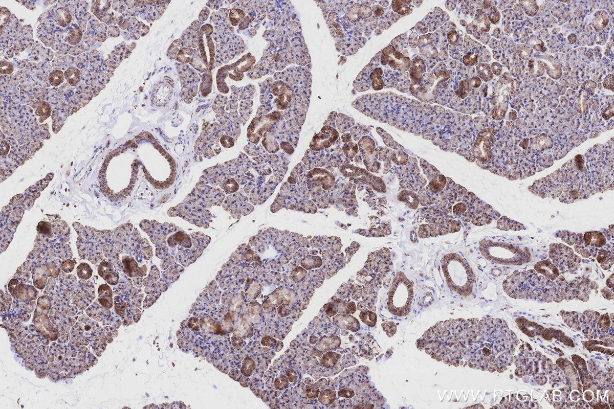 Immunohistochemistry (IHC) staining of rat salivary gland tissue using COX6A1 Polyclonal antibody (11460-1-AP)