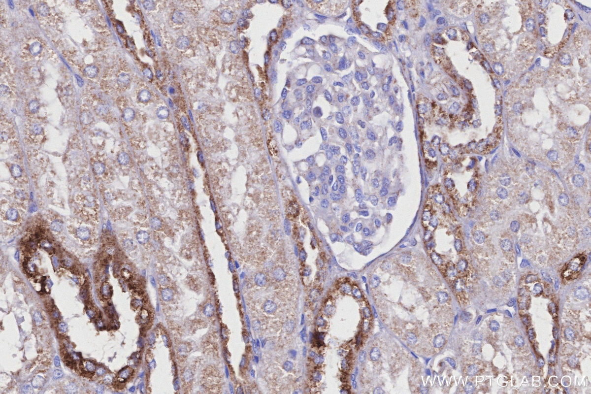 Immunohistochemistry (IHC) staining of human kidney tissue using COX6A1 Polyclonal antibody (11460-1-AP)