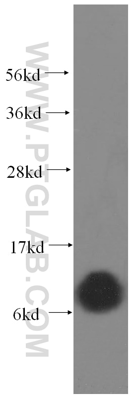 Western Blot (WB) analysis of human brain tissue using COX6A1 Polyclonal antibody (11460-1-AP)