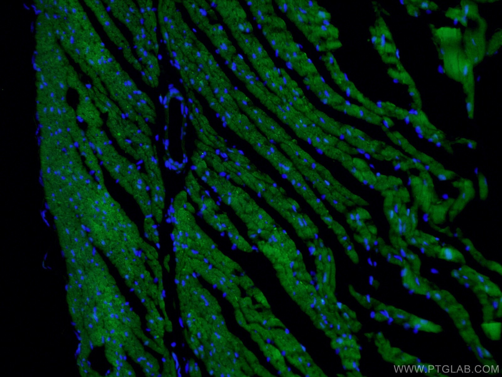 Immunofluorescence (IF) / fluorescent staining of human heart tissue using COX6A2 Polyclonal antibody (11421-1-AP)