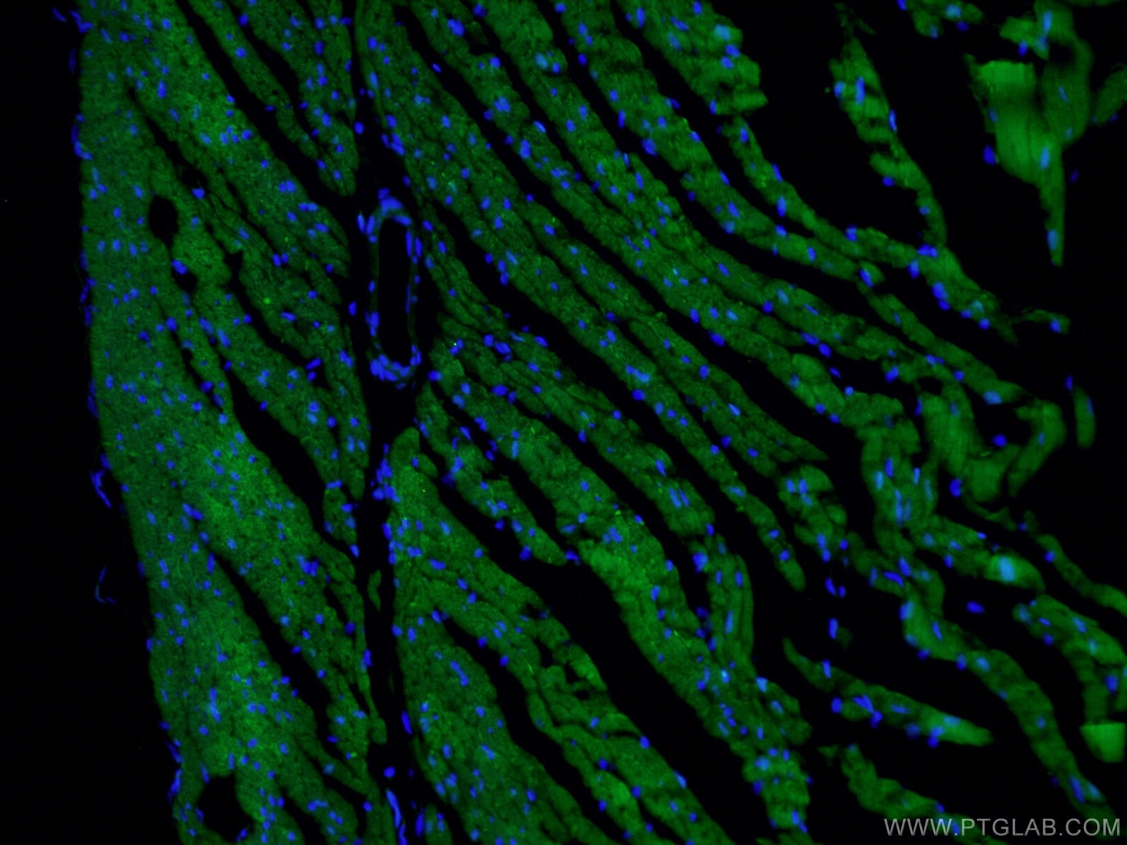 IF Staining of human heart using 11421-1-AP