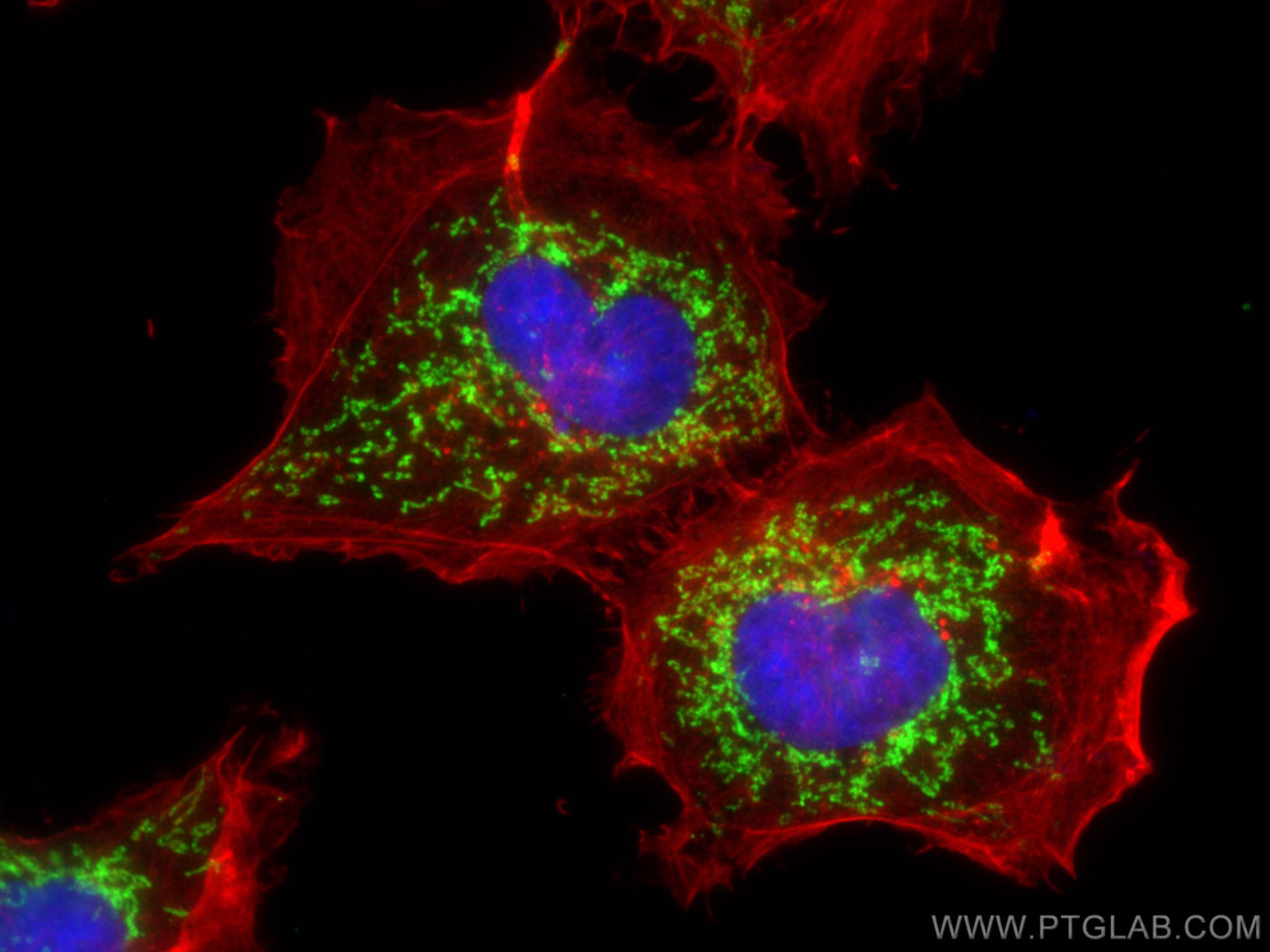 Immunofluorescence (IF) / fluorescent staining of A431 cells using COX6B1 Polyclonal antibody (11425-1-AP)