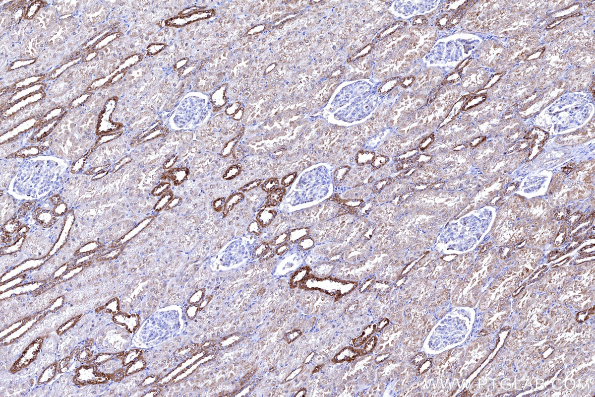 Immunohistochemistry (IHC) staining of human kidney tissue using COX6B1 Polyclonal antibody (11425-1-AP)