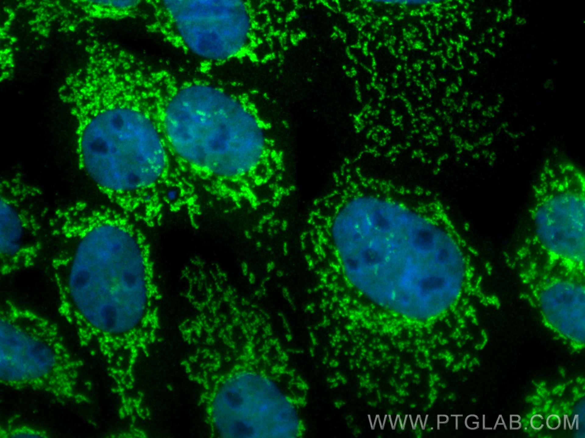 Immunofluorescence (IF) / fluorescent staining of A431 cells using CoraLite® Plus 488-conjugated COX6B1 Polyclonal an (CL488-11425)