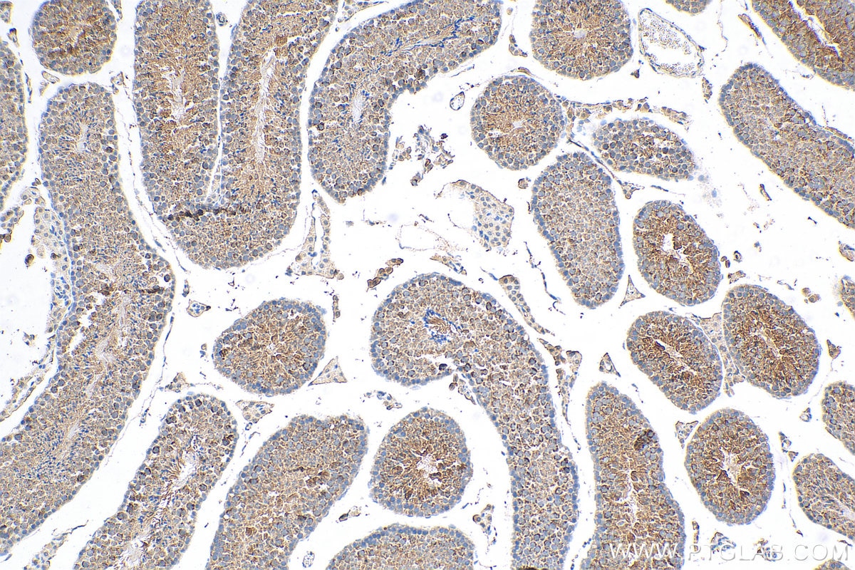 IHC staining of mouse testis using 11437-1-AP