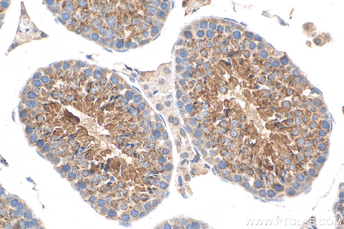 Immunohistochemistry (IHC) staining of mouse testis tissue using COX6B2 Polyclonal antibody (11437-1-AP)