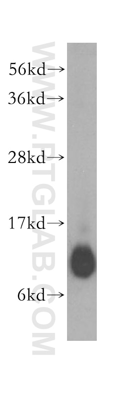 Western Blot (WB) analysis of human brain tissue using COX7A1 Polyclonal antibody (11413-1-AP)