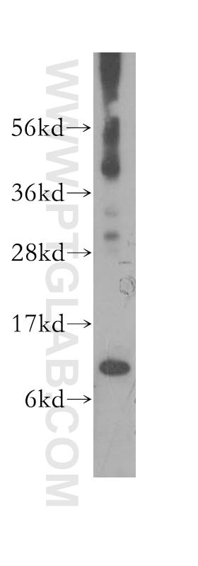 Western Blot (WB) analysis of human kidney tissue using COX7A1 Polyclonal antibody (11413-1-AP)