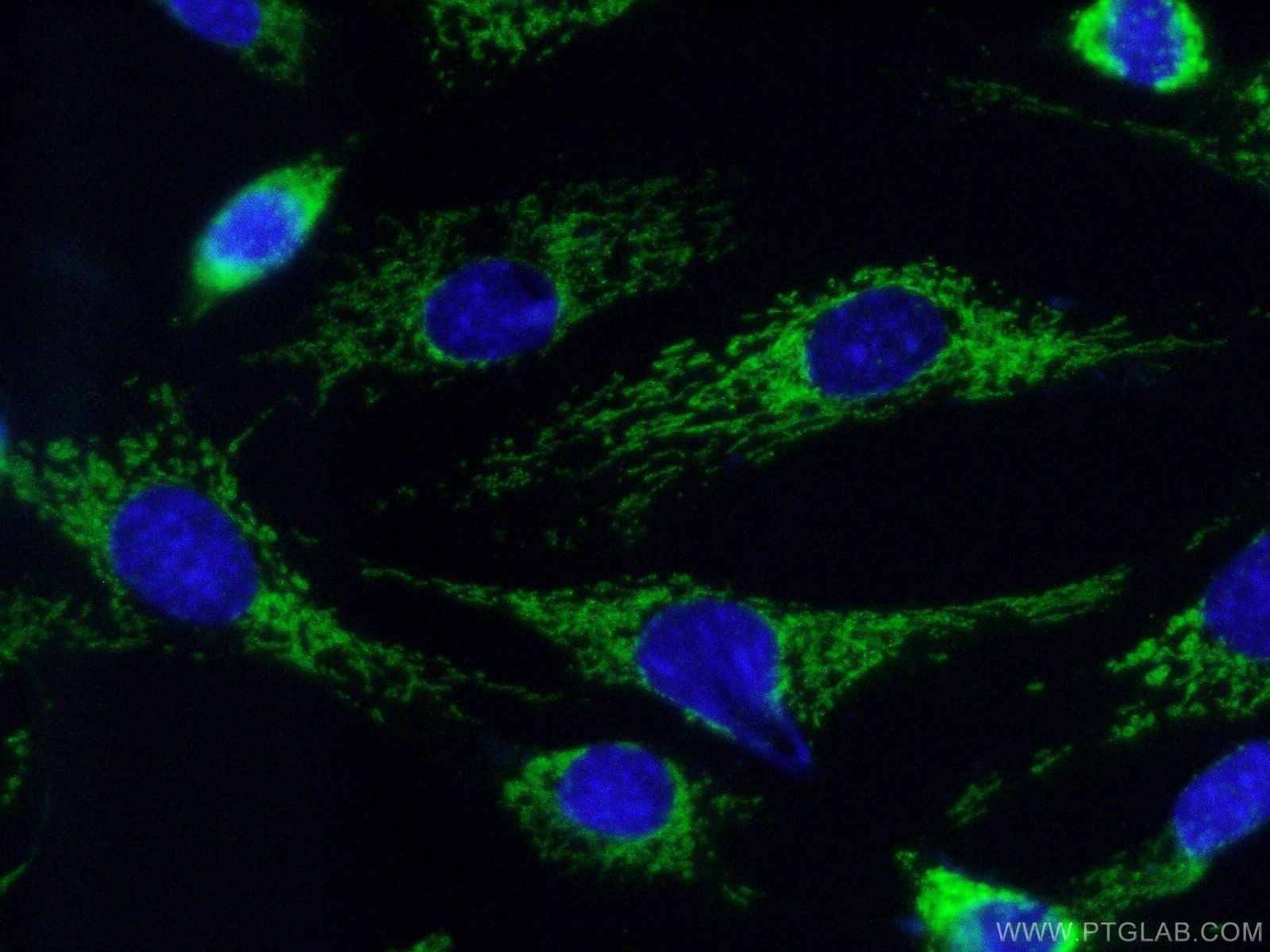 IF Staining of NIH/3T3 using 18122-1-AP