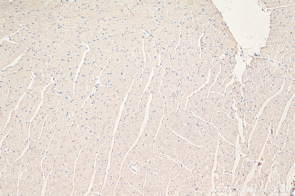 IHC staining of mouse heart using 11417-2-AP