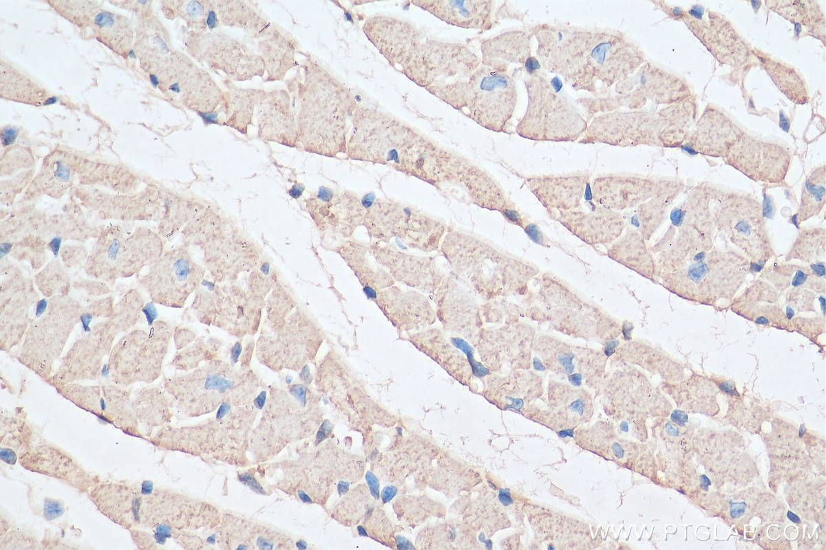 IHC staining of mouse heart using 11417-2-AP