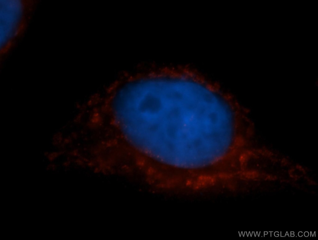 IF Staining of MCF-7 using 11411-2-AP