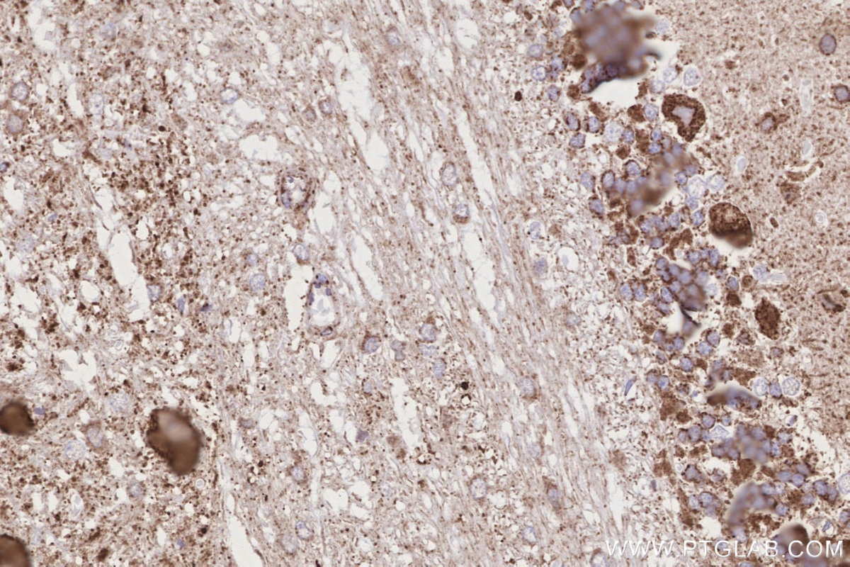 Immunohistochemistry (IHC) staining of rat cerebellum tissue using COX7C Polyclonal antibody (11411-2-AP)