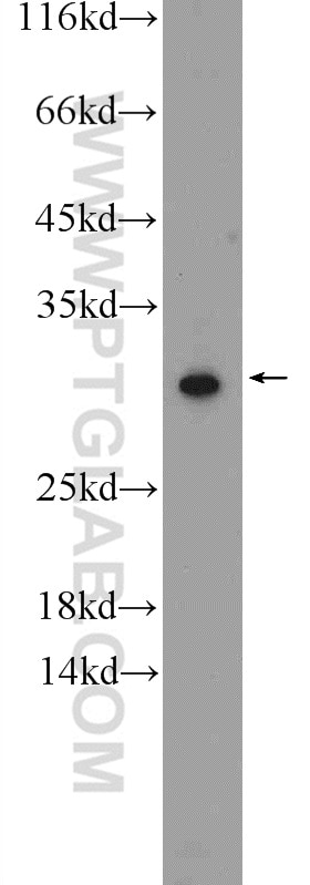 Western Blot (WB) analysis of human skeletal muscle tissue using COX7C Polyclonal antibody (11411-2-AP)