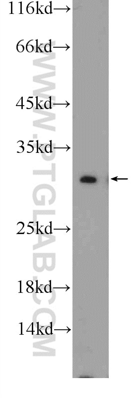 Western Blot (WB) analysis of mouse ovary tissue using COX7C Polyclonal antibody (11411-2-AP)