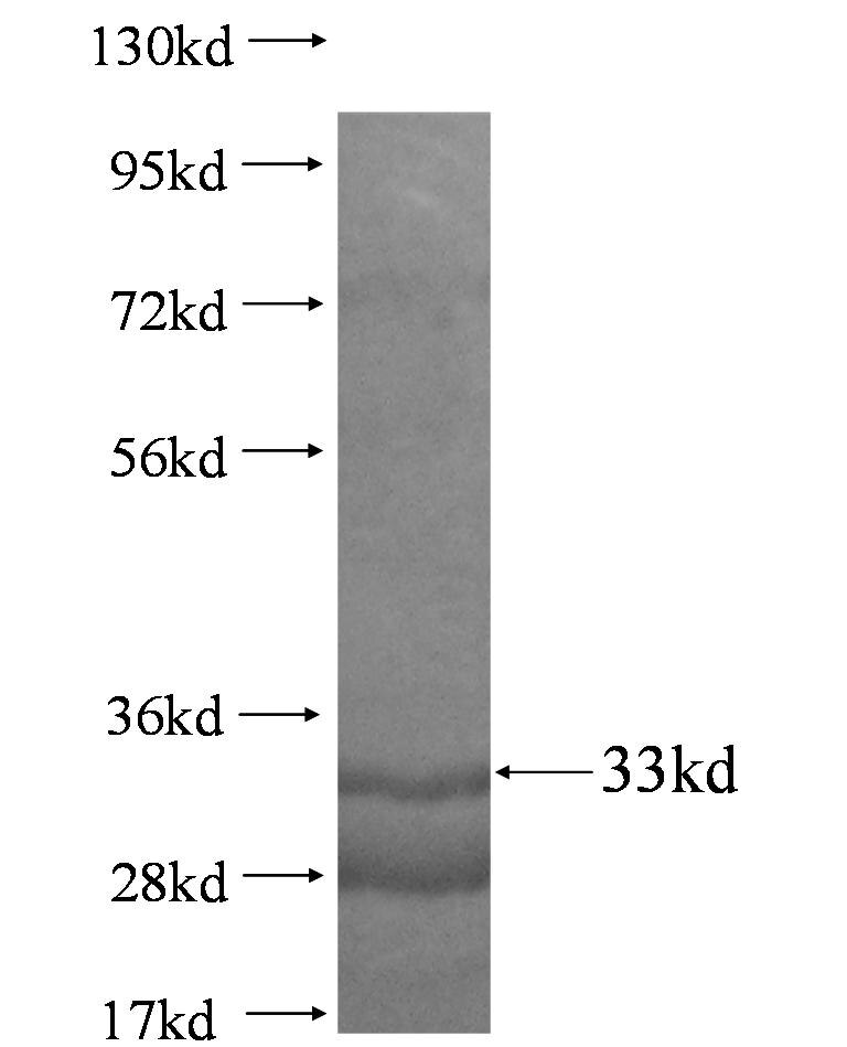 COX7C fusion protein Ag1989 SDS-PAGE