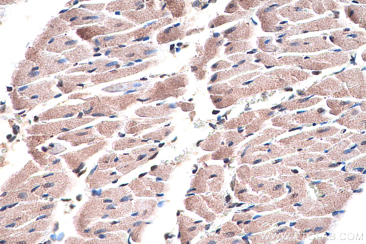 Immunohistochemistry (IHC) staining of rat heart tissue using COX8A Polyclonal antibody (15368-1-AP)