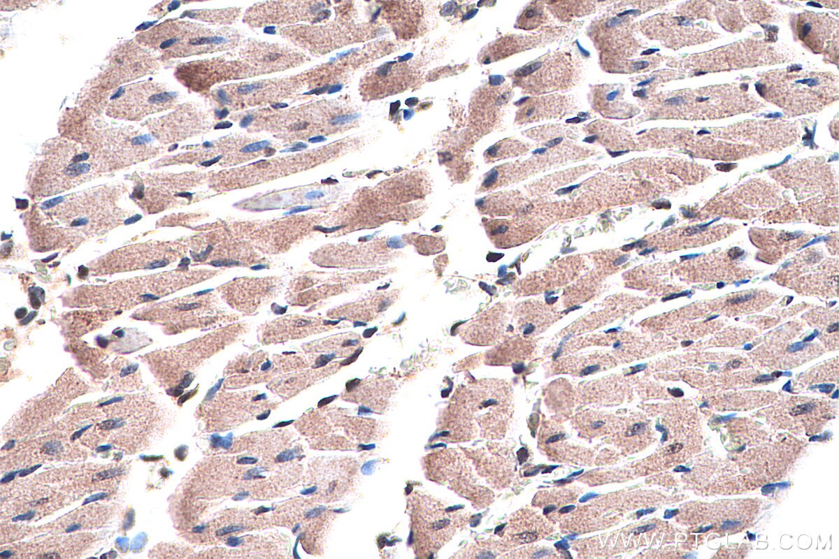 IHC staining of rat heart using 15368-1-AP