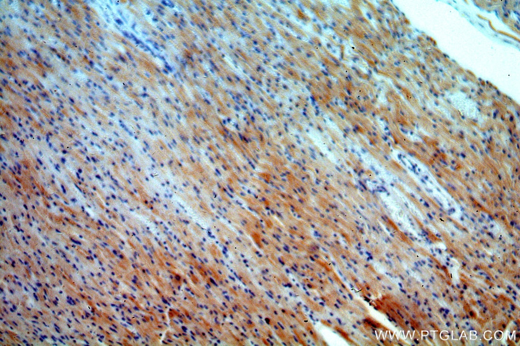 Immunohistochemistry (IHC) staining of human heart tissue using COX8A Polyclonal antibody (15368-1-AP)