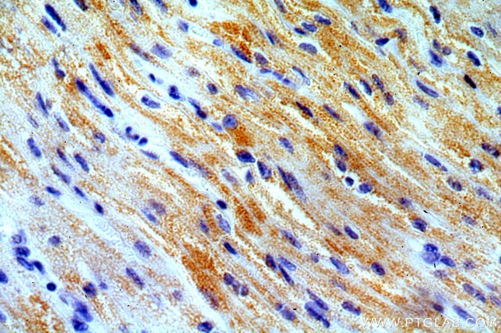 Immunohistochemistry (IHC) staining of human heart tissue using COX8A Polyclonal antibody (15368-1-AP)