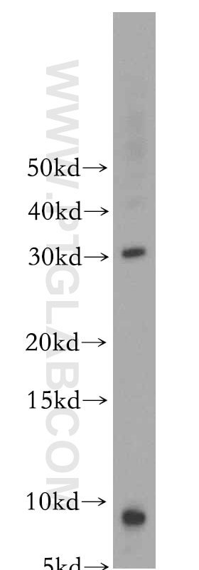 Western Blot (WB) analysis of mouse skeletal muscle tissue using COX8A Polyclonal antibody (15368-1-AP)