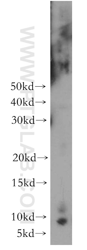 WB analysis of human skeletal muscle using 15368-1-AP