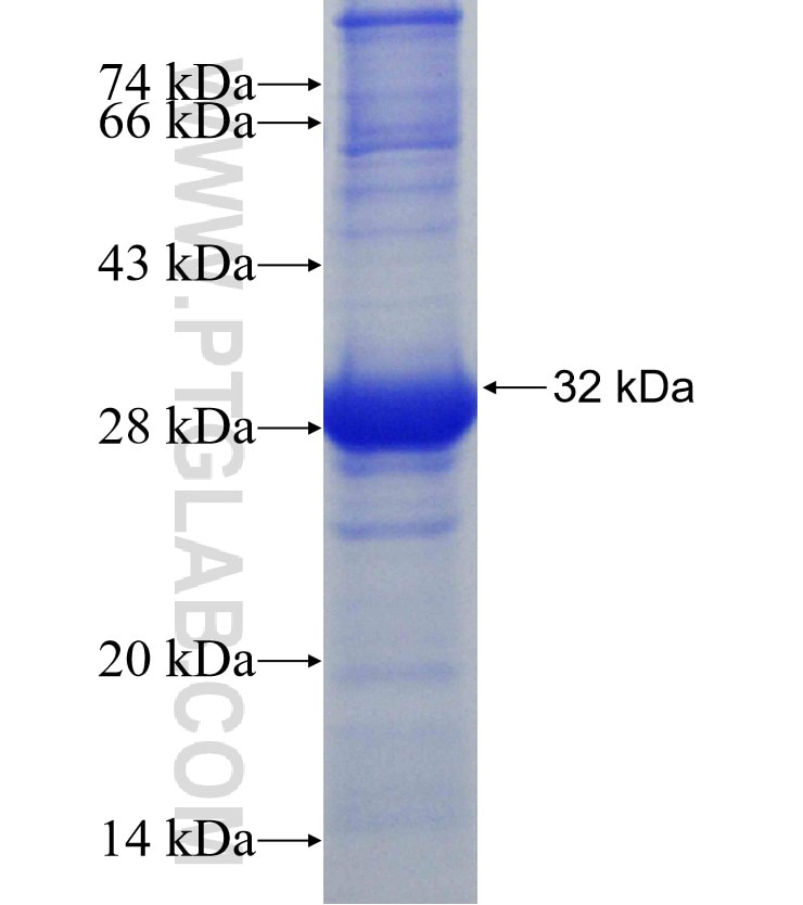 COX8A fusion protein Ag2885 SDS-PAGE
