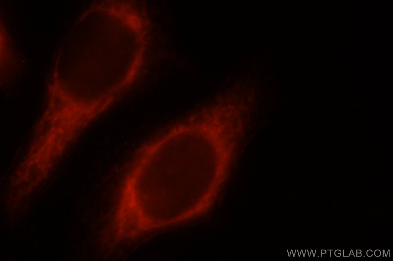 Immunofluorescence (IF) / fluorescent staining of HeLa cells using COXIV Monoclonal antibody (60251-1-Ig)