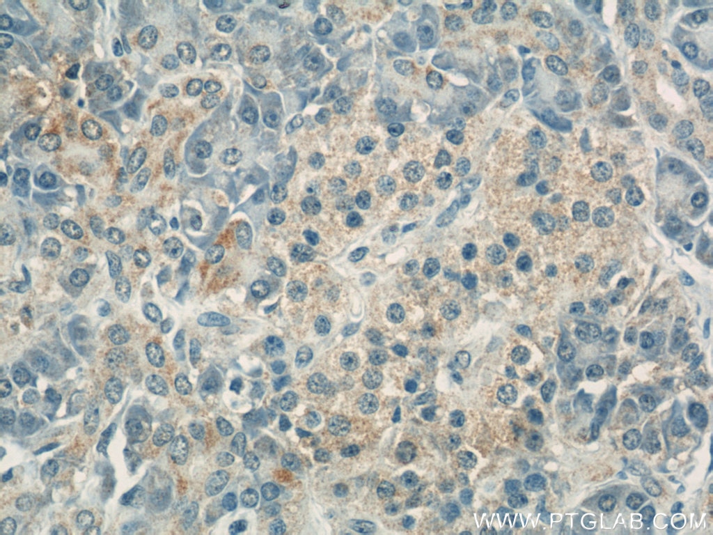 Immunohistochemistry (IHC) staining of human pancreas tissue using COXIV Monoclonal antibody (60251-1-Ig)