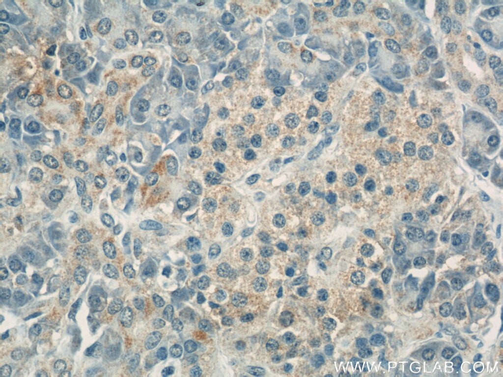 IHC staining of human pancreas using 60251-1-Ig