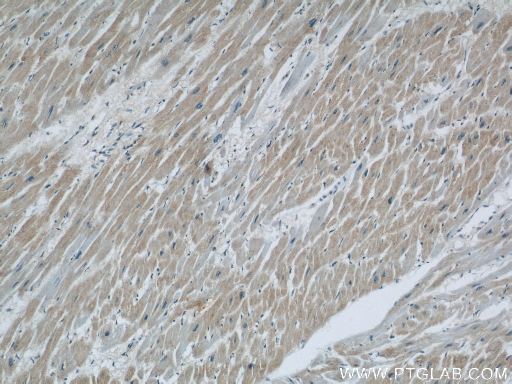 Immunohistochemistry (IHC) staining of human heart tissue using COXIV Monoclonal antibody (60251-1-Ig)