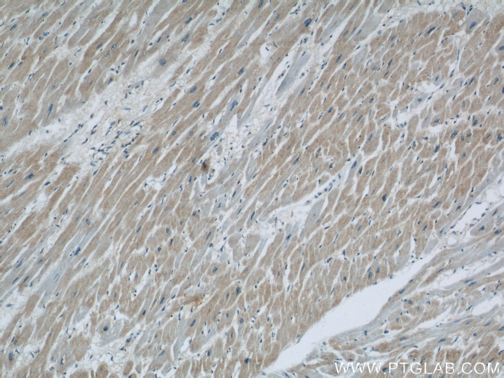 IHC staining of human heart using 60251-1-Ig